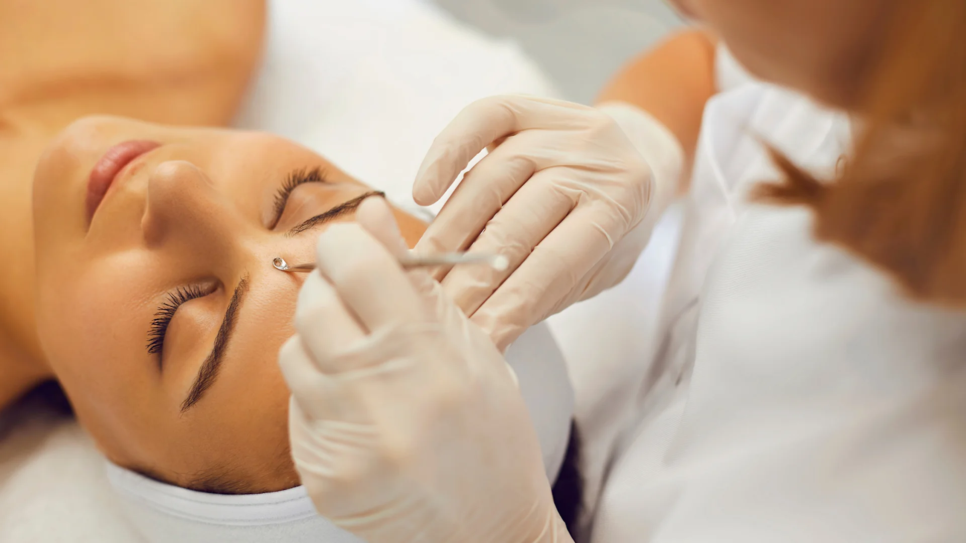 Traitement de l'acné et des boutons 1 Traitement de l'acné et des boutons