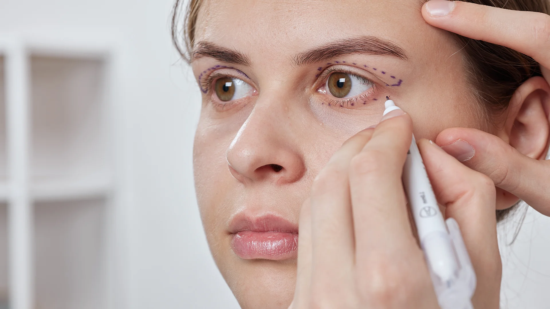 Non-Surgical Periorbital Treatments 1 Non-Surgical Periorbital Treatments