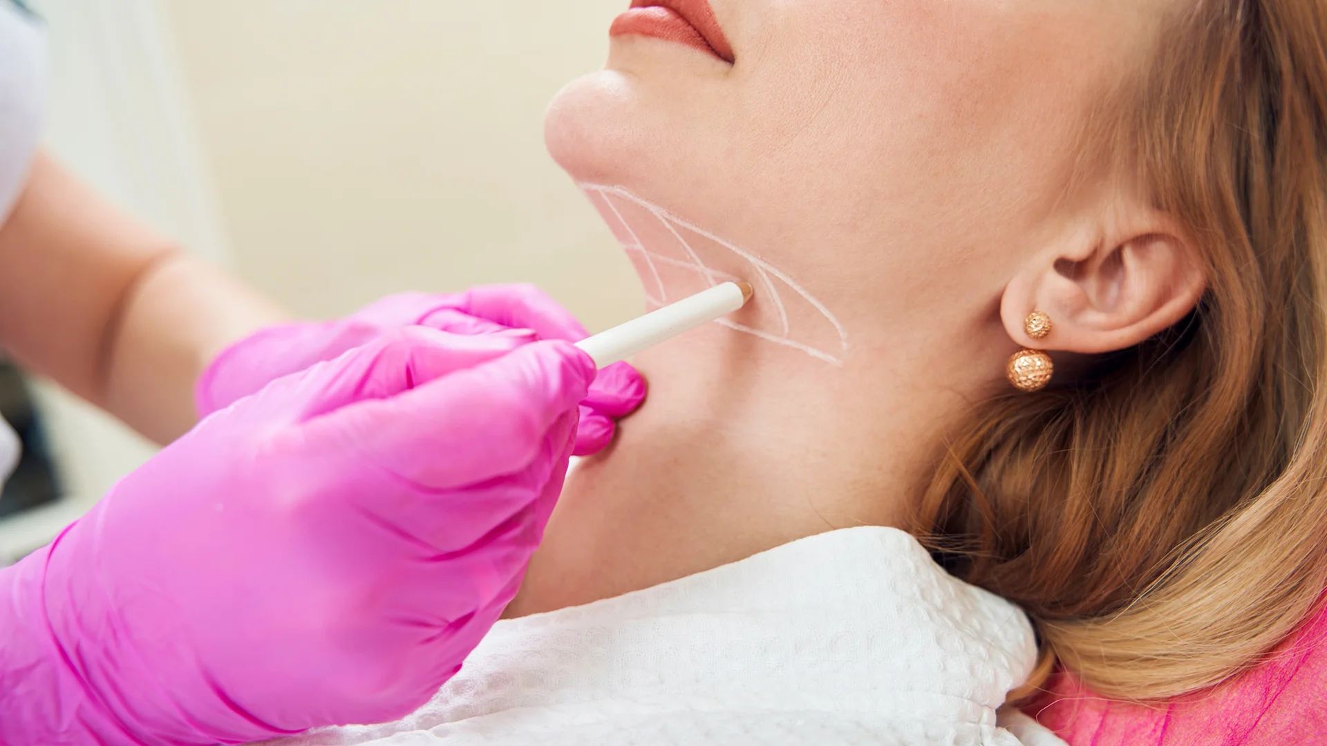 Neck Rejuvenation 1 Neck Rejuvenation