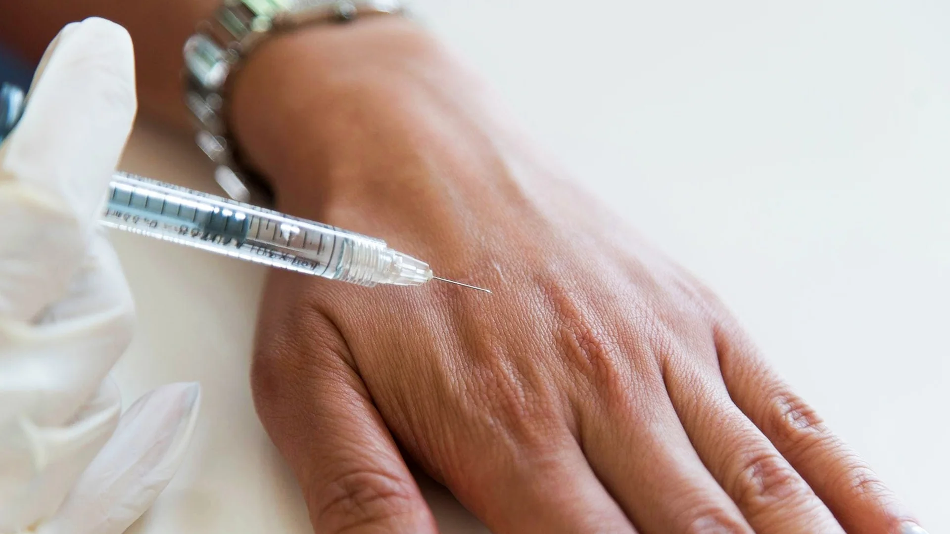 Hand Rejuvenation 1 Hand Rejuvenation