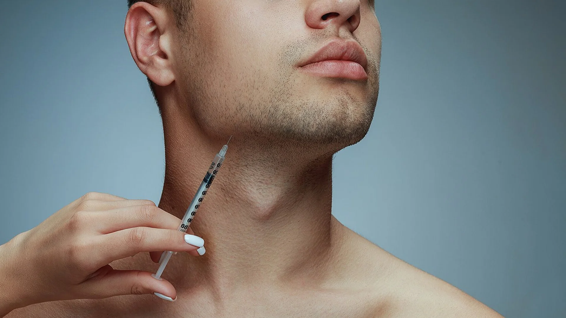 Jawline Filler 1 jawline filler