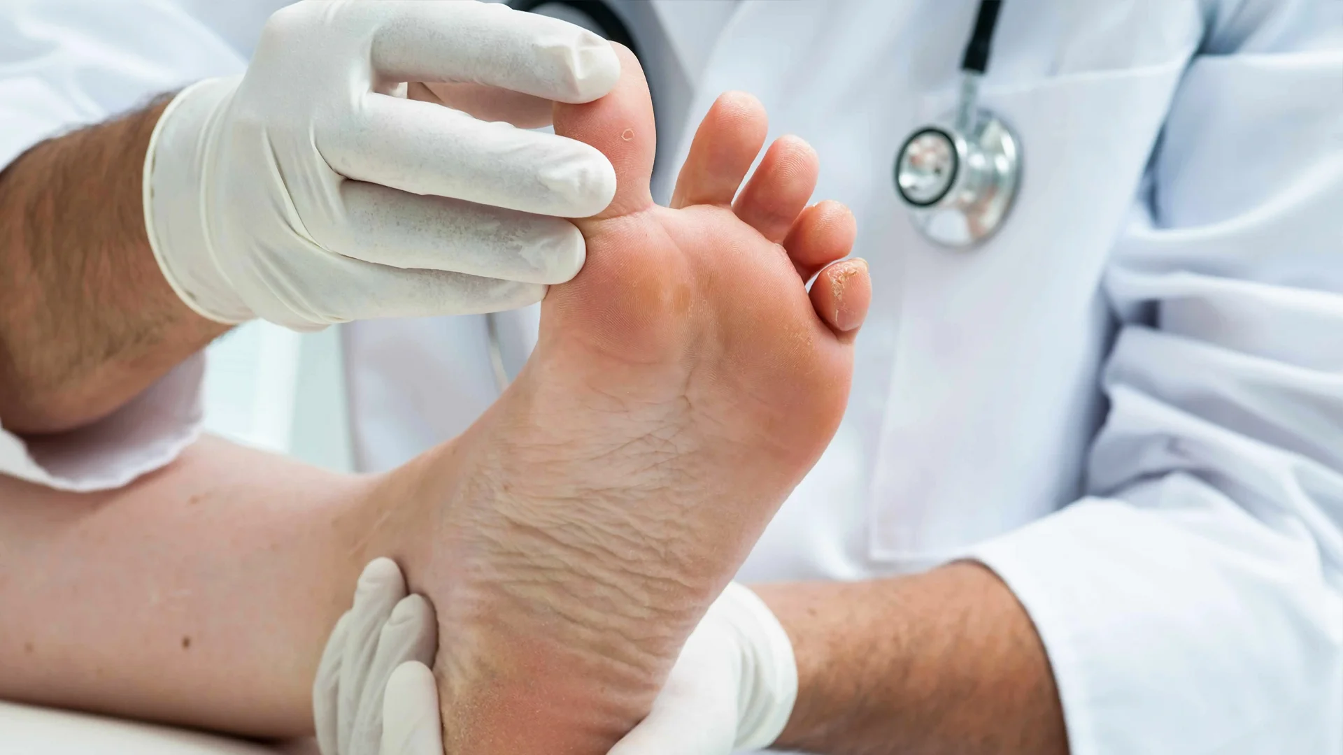 Behandlung von Pilzinfektionen 1 Behandlung von Pilzinfektionen