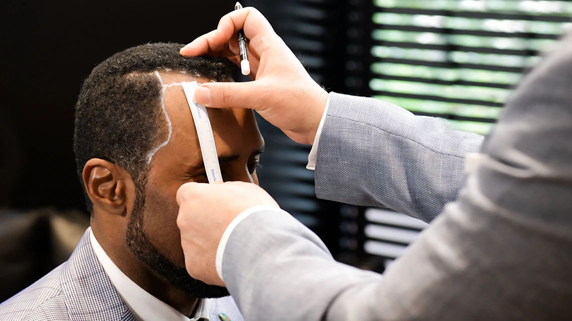 Afro-American Hair Transplant 1 Afro-American Hair Transplant