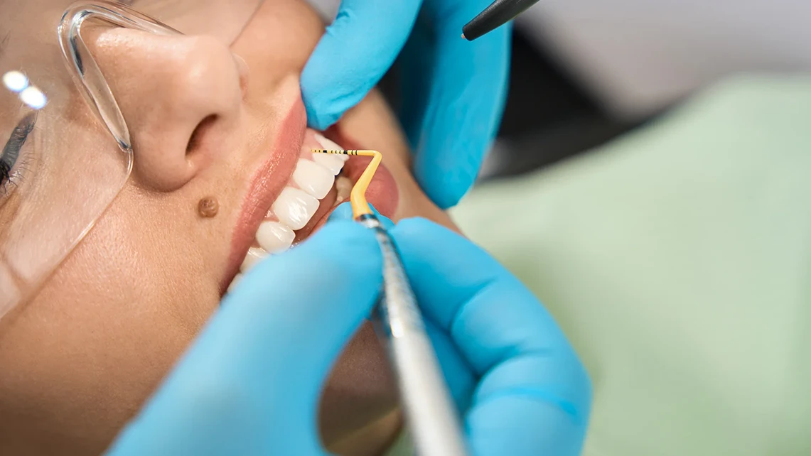 Ceramic Crown 1 ceramic crown in turkey