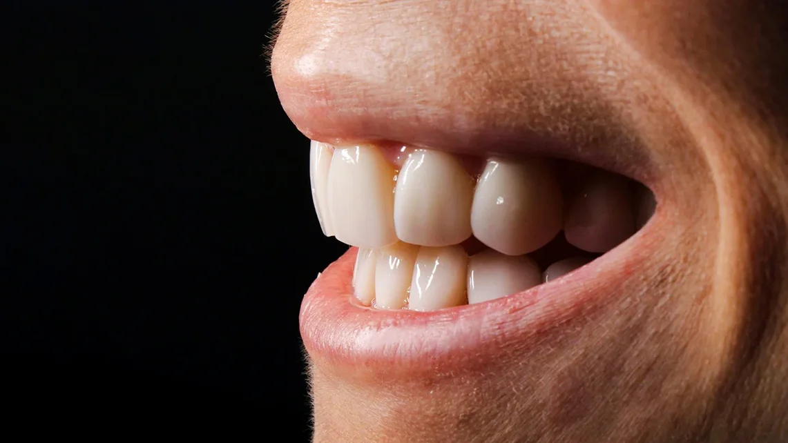 Unión compuesta 1 Unión compuesta