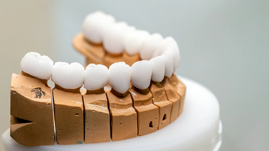 Emax Crown 1 Emax Crown