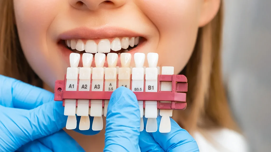 Porcelain Veneers 1 Porcelain Veneers