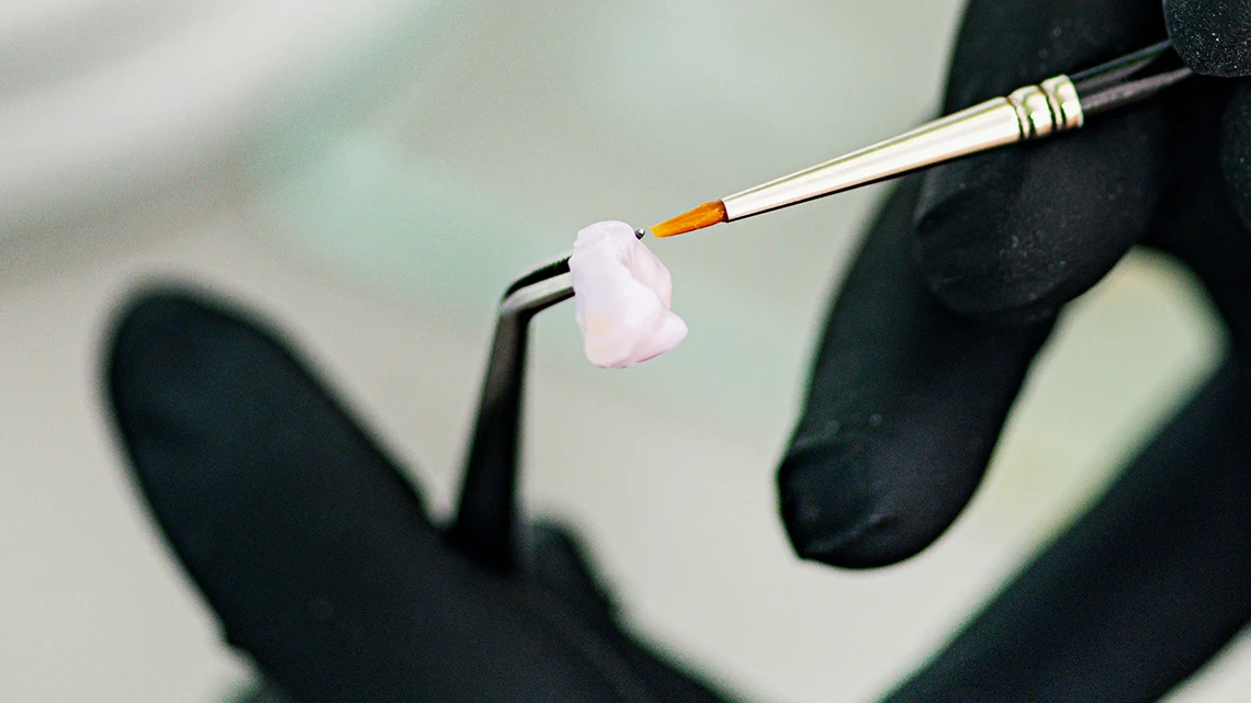 Porcelain Crown 1 Porcelain Crown