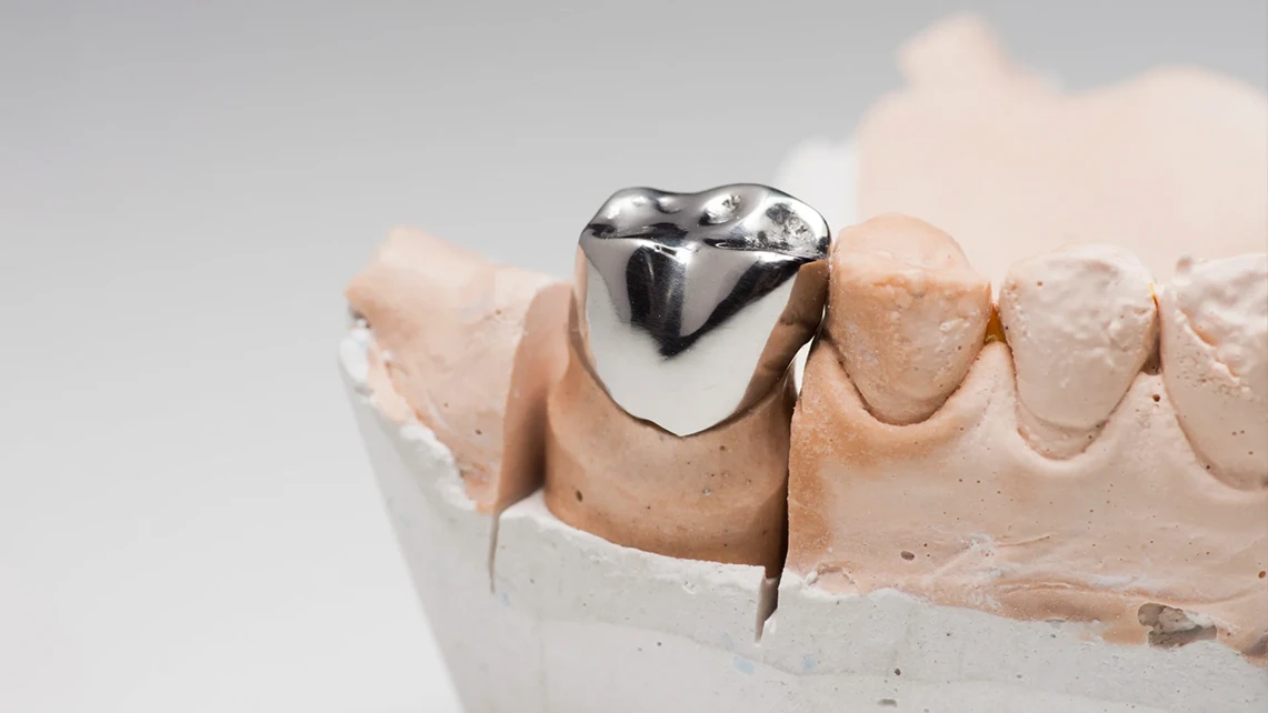 Silver Crowns 1 Silver Crowns