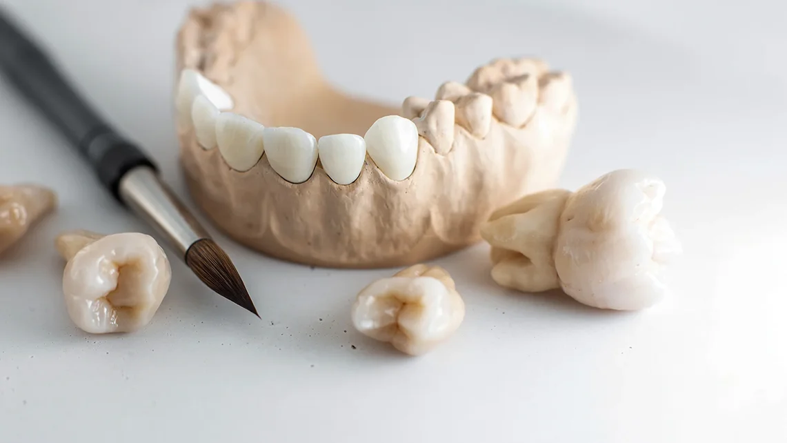 Zirconium Crowns 1 zirconium crowns in turkey