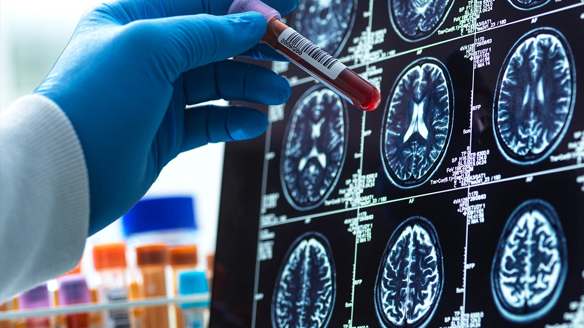 Neurological Treatments 1 Neurological Treatments