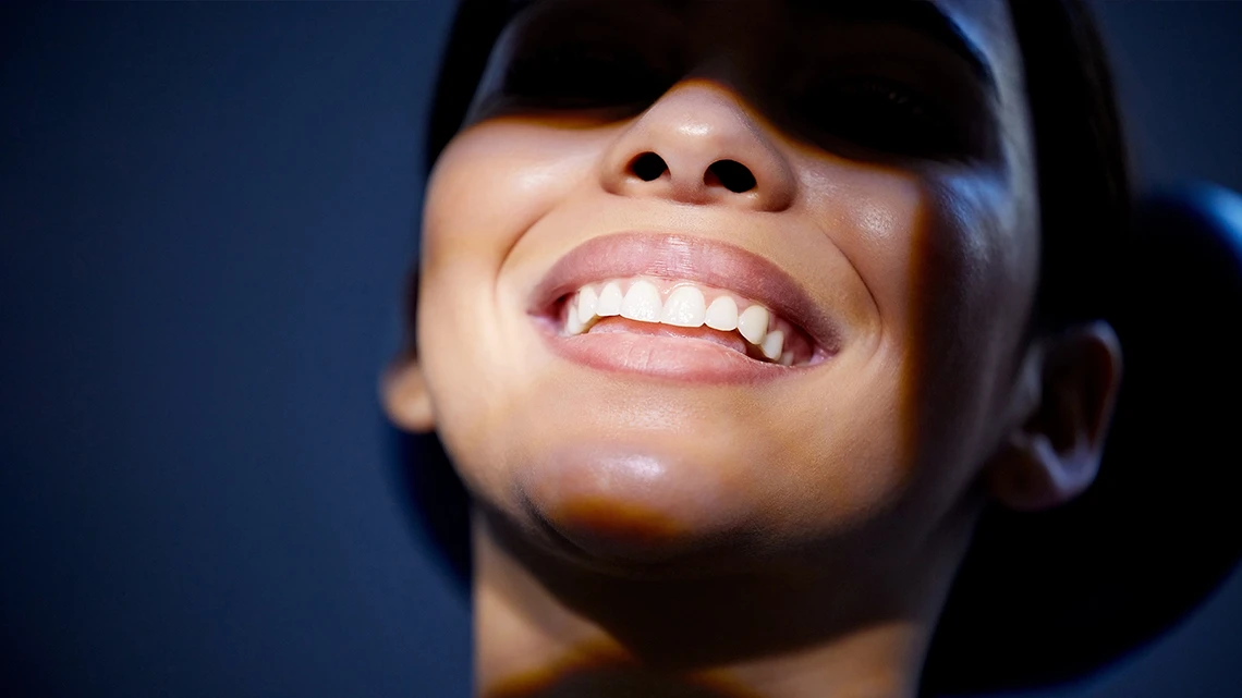 Hollywood Smile 1 hollywood smile in turkey