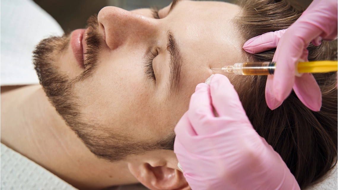 Exosome for Skin Treatment 1 Exosome for Skin Treatment