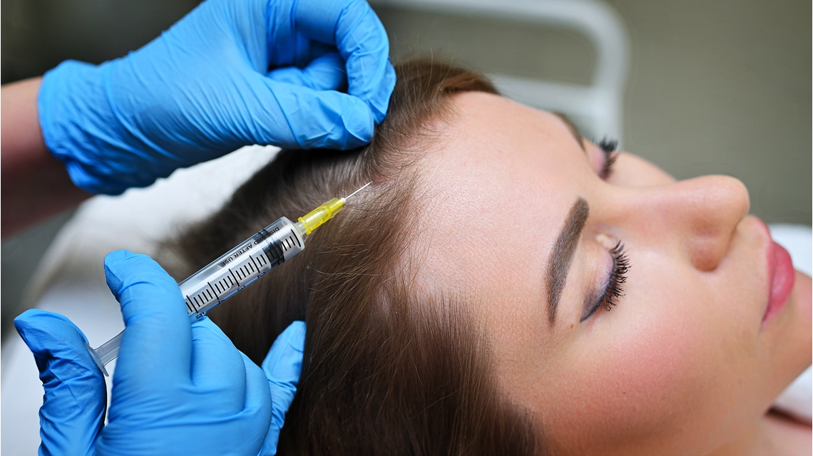 Exosome for Hair Treatment 1 Exosome for Hair Treatment